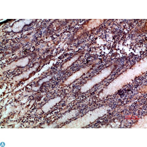 Polyclonal Rabbit anti-Human NOX1 Antibody (IHC, WB)