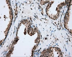 PIM2 / Pim-2 Antibody (clone OTI8H10)
