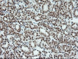 ERCC1 Antibody (clone 2.00E+12)