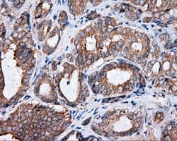 PIM2 / Pim-2 Antibody (clone OTI5B5)