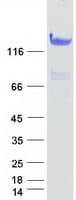 Human HDAC6 Protein (Recombinant Myc-DDK (Flag))
