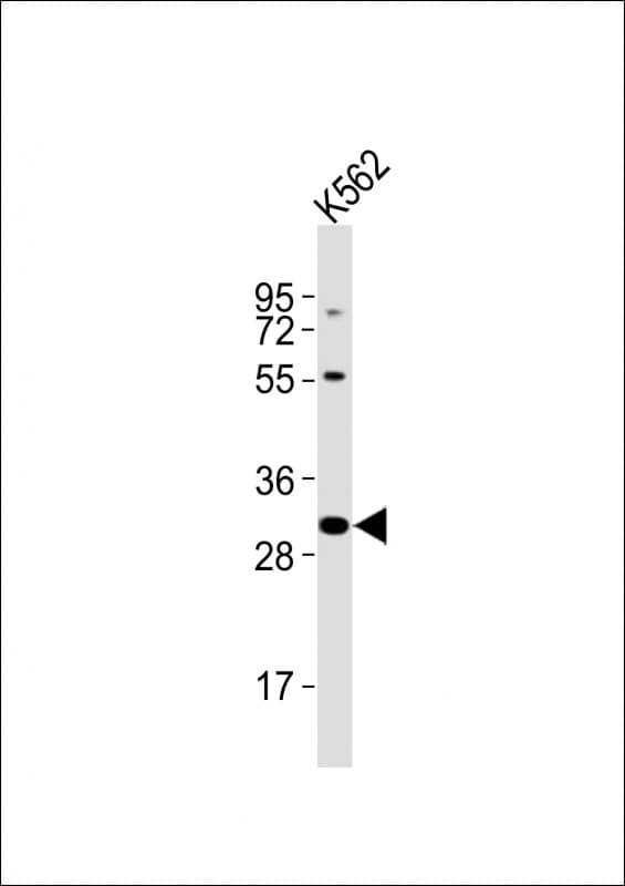 Polyclonal Rabbit anti-Human RNF2 / RING2 / RING1B Antibody (aa160-194, WB)