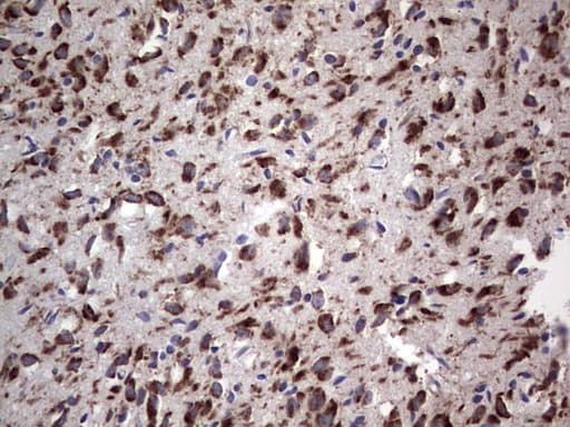 ANO1 / DOG1 / TMEM16A Antibody (aa1-333, clone OTI1C8)