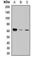 Polyclonal Rabbit anti-Human STXBP4 Antibody (IHC, WB)