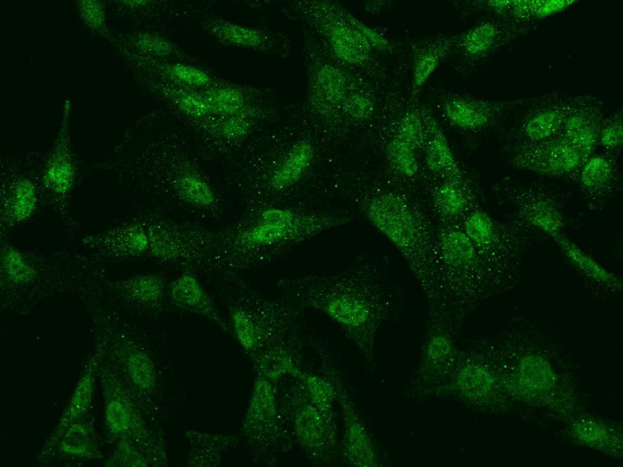 Polyclonal Rabbit anti-Human SBNO2 Antibody (IHC, IF)