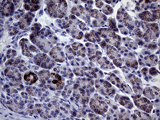 Monoclonal Mouse anti-Human CLIP4 / RSNL2 Antibody (clone OTI5D10, IHC, WB)