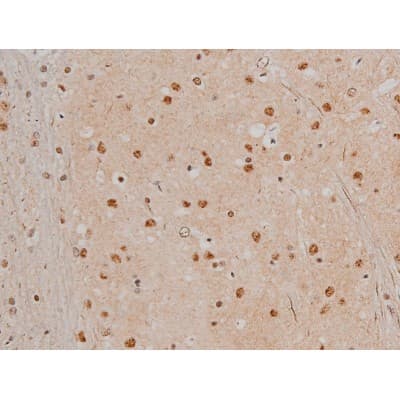 Polyclonal Rabbit anti-Human FLNA / Filamin A Antibody (phospho-Ser2152, IHC, IF, WB)