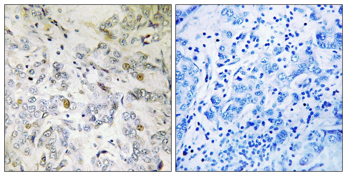 SARNP / Hcc-1 / CIP29 Antibody