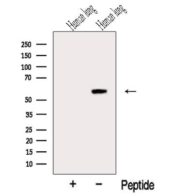 Polyclonal Rabbit anti-Human RASSF10 Antibody (WB)