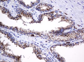GLB1 / Beta-Galactosidase Antibody (clone OTI1C9)