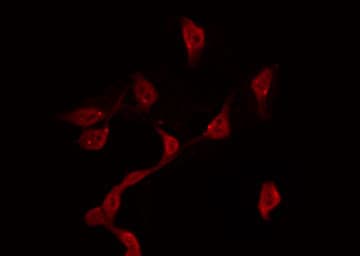 HSP90B1 / GP96 / GRP94 Antibody