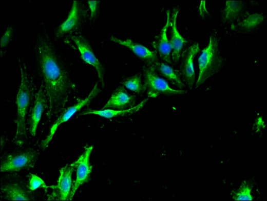 Polyclonal Rabbit anti-Human TRIM39 / RNF23 Antibody (IHC, IF, WB)