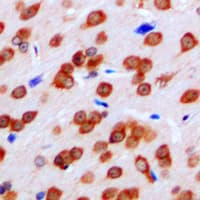 FPR1 / FPR Antibody (Internal)