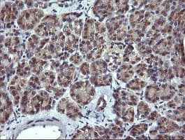 MLANA / Melan-A Antibody (clone OTI3E2, Carrier-free)