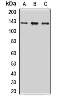 Polyclonal Rabbit anti-Human SIPA1 Antibody (WB)