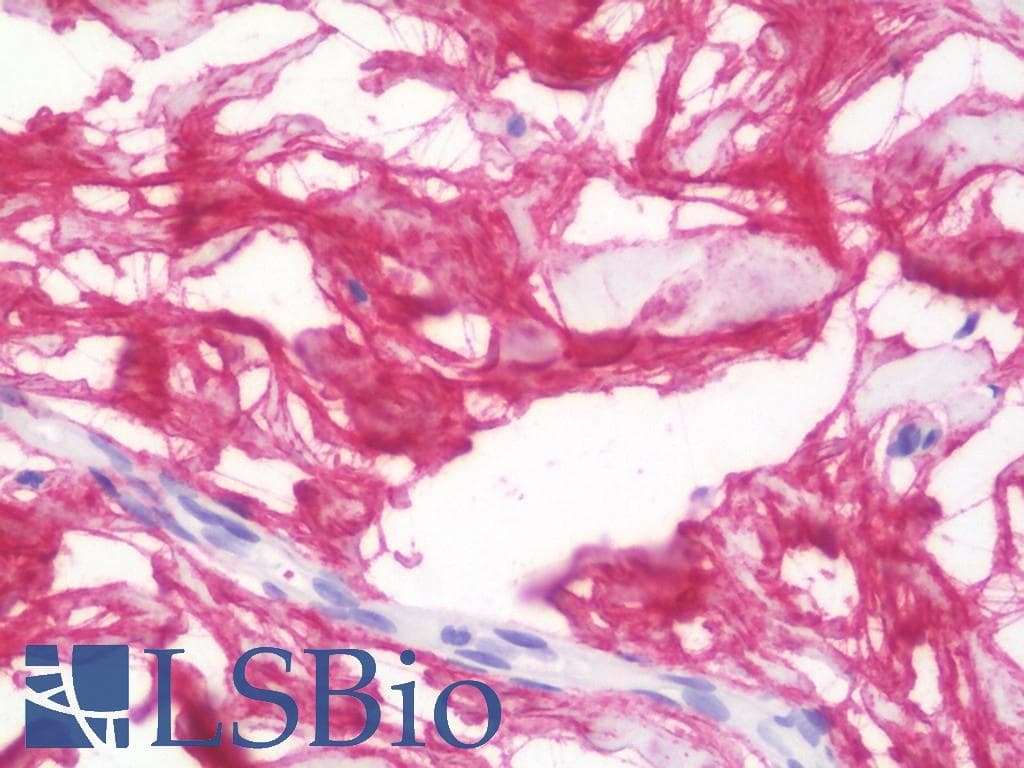 IHC-plus™ Polyclonal Rabbit anti-Human Lumican Antibody (aa198-227, IHC, WB)