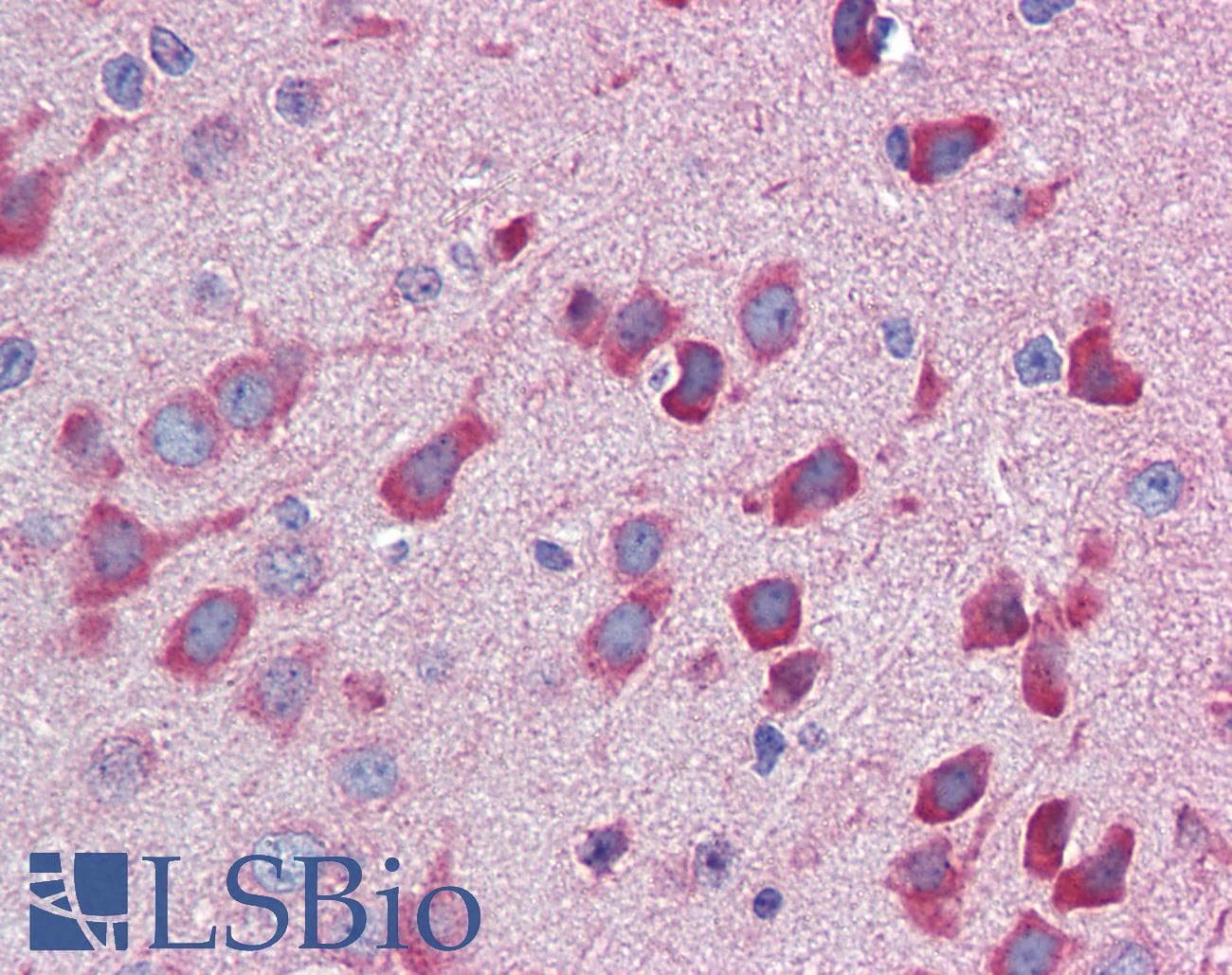 PathPlus™ IL23A / IL-23 p19 Antibody