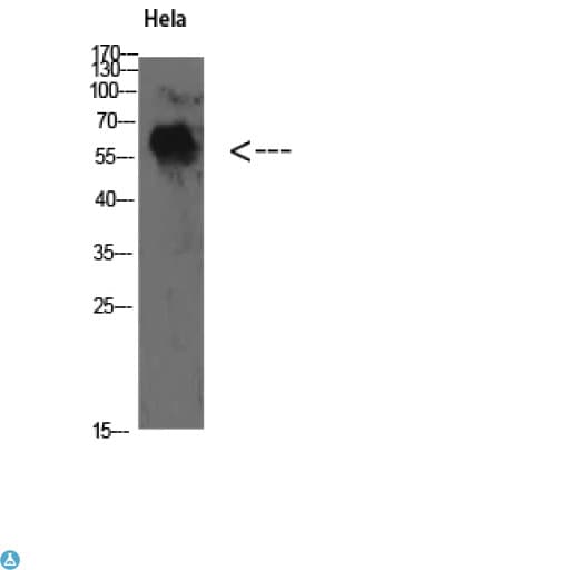 Polyclonal Rabbit anti-Human YARS / Tyrosyl-tRNA Synthetase Antibody (WB)