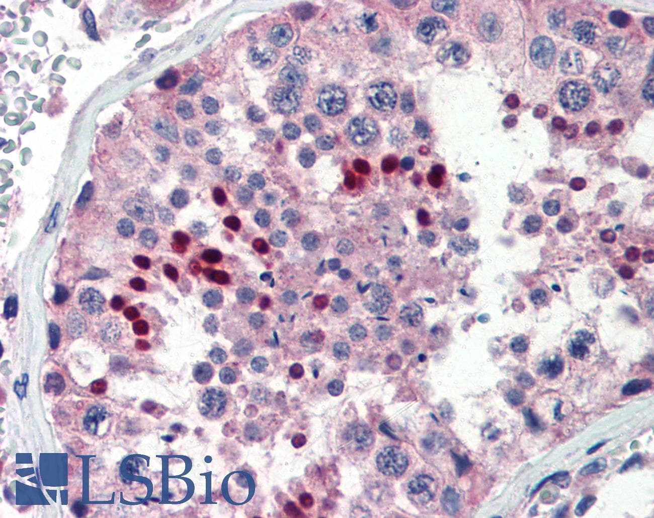 NR0B1 / DAX1 Antibody (aa359-408)