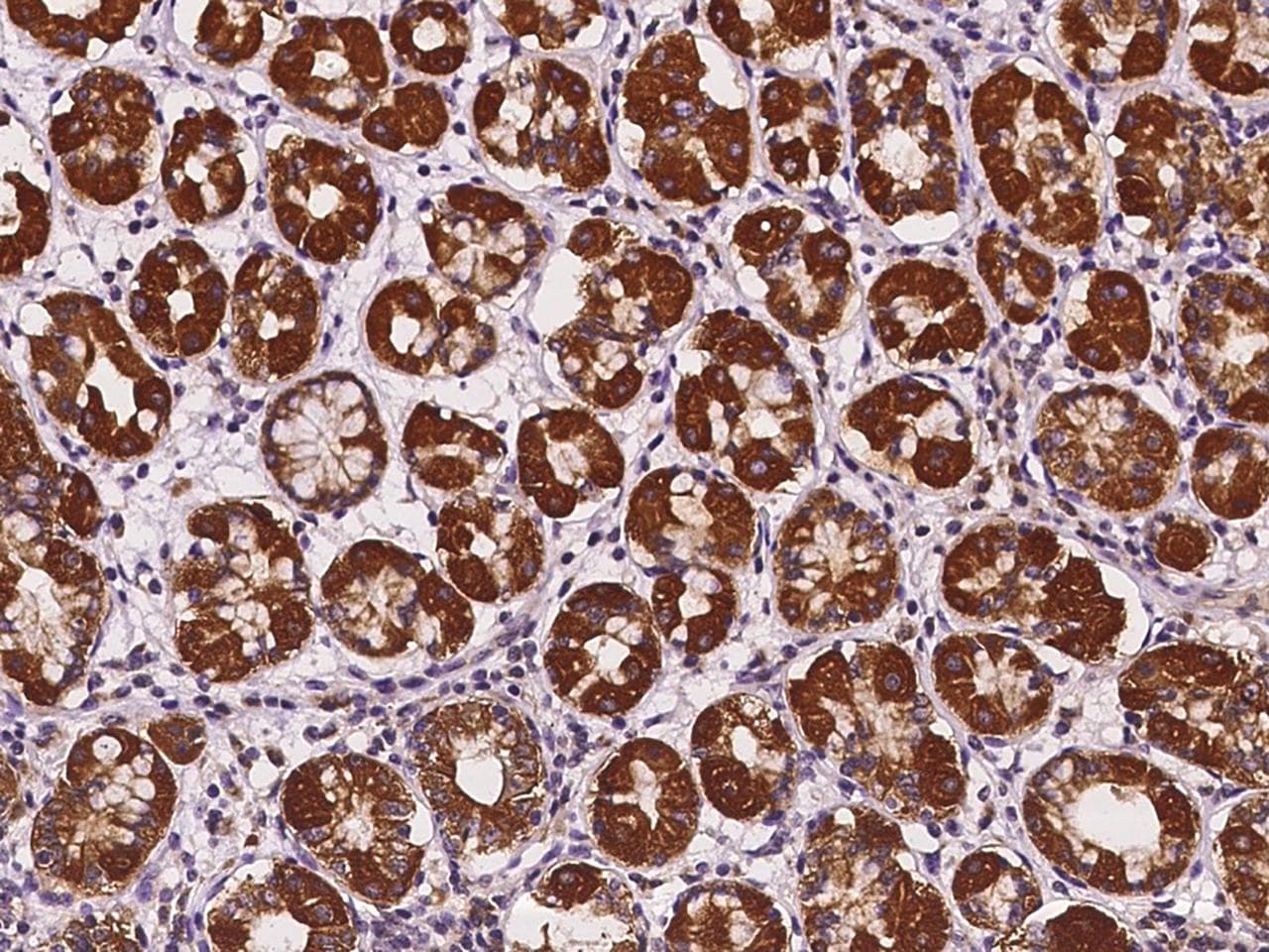 SPINT1 / HAI-1 Antibody