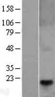 Human TCAP / Telethonin Protein (Over-Expression Lysate Myc-DDK (Flag))