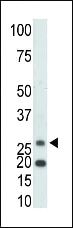 KHK / Ketohexokinase Antibody (aa251-281)