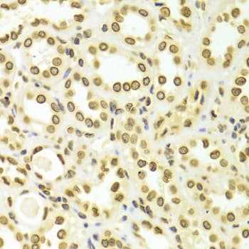 LMNA / Lamin A+C Antibody
