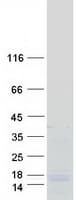 Human SREK1IP1 Protein (Recombinant Myc-DDK (Flag))