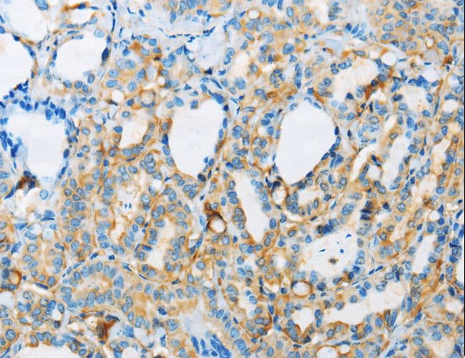 ARSA / Arylsulfatase A Antibody