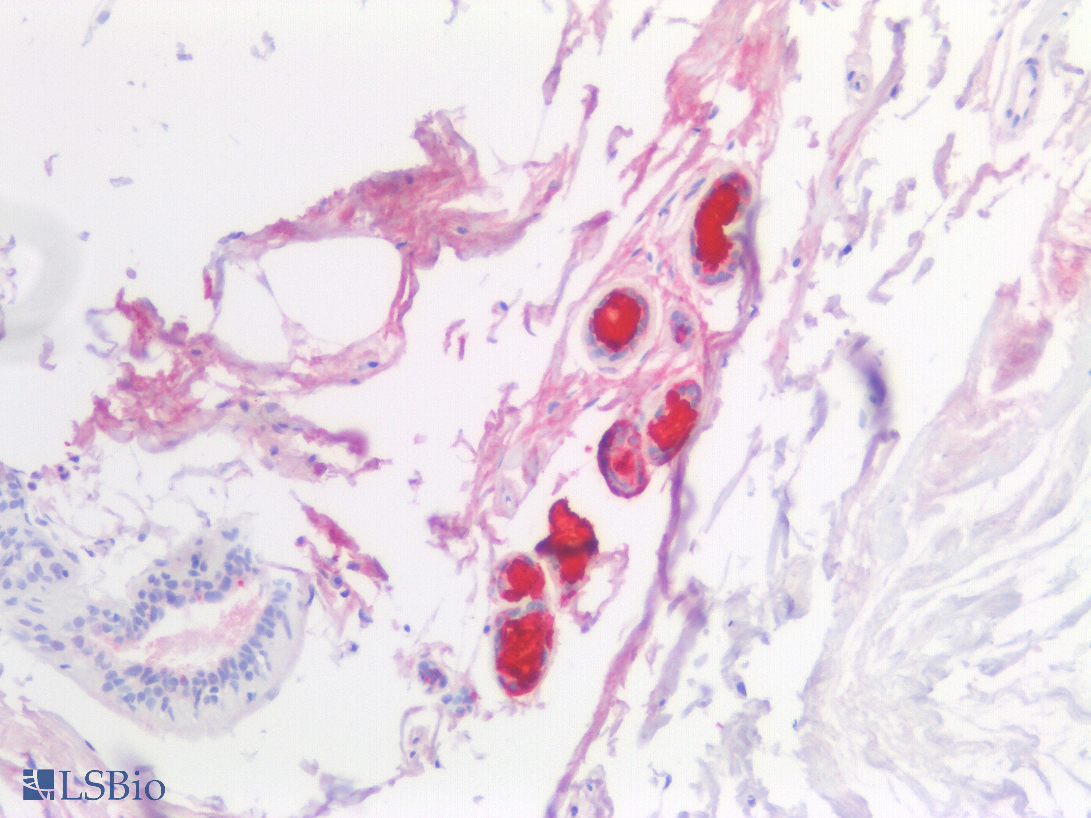 PathPlus™ Polyclonal Rabbit anti-Human SCGB1D2 / Lipophilin B Antibody (aa22-90, IHC, WB)