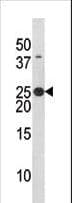 BAD Antibody (phospho-Ser134)