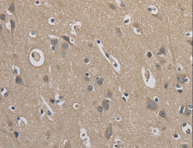 EMC8 / COX4NB Antibody
