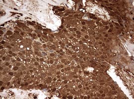Monoclonal Mouse anti-Human GAPDH Antibody (clone OTI2F8, IHC, WB)
