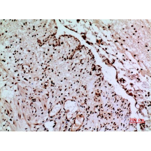 Polyclonal Rabbit anti-Human CACYBP Antibody (161-210 aa, C-terminal, IHC, WB)