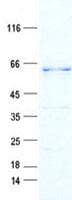 Human EGFR Protein (Recombinant DDK,C-terminus)