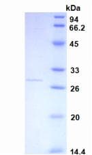 Human CRP / C-Reactive Protein (Recombinant His-T7)