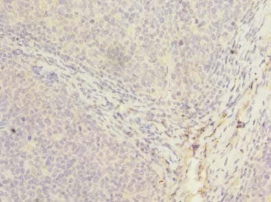 Polyclonal Rabbit anti-Human PPIH / Cyclophilin H Antibody (IHC, WB)