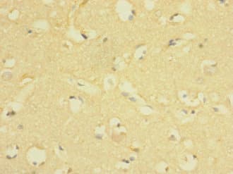 Polyclonal Rabbit anti-Human LRIG1 Antibody (IHC)