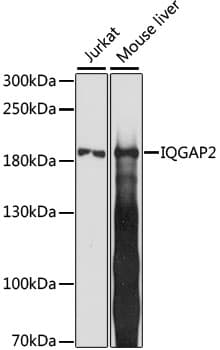 Polyclonal Rabbit anti-Human IQGAP2 Antibody (WB)