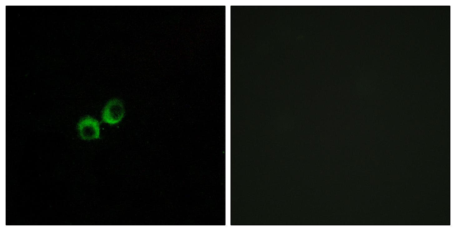 T1R3 / TAS1R3 Antibody