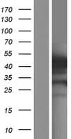 GSDMB / Gasdermin-Like Protein (Over-Expression Lysate Myc-DDK (Flag))