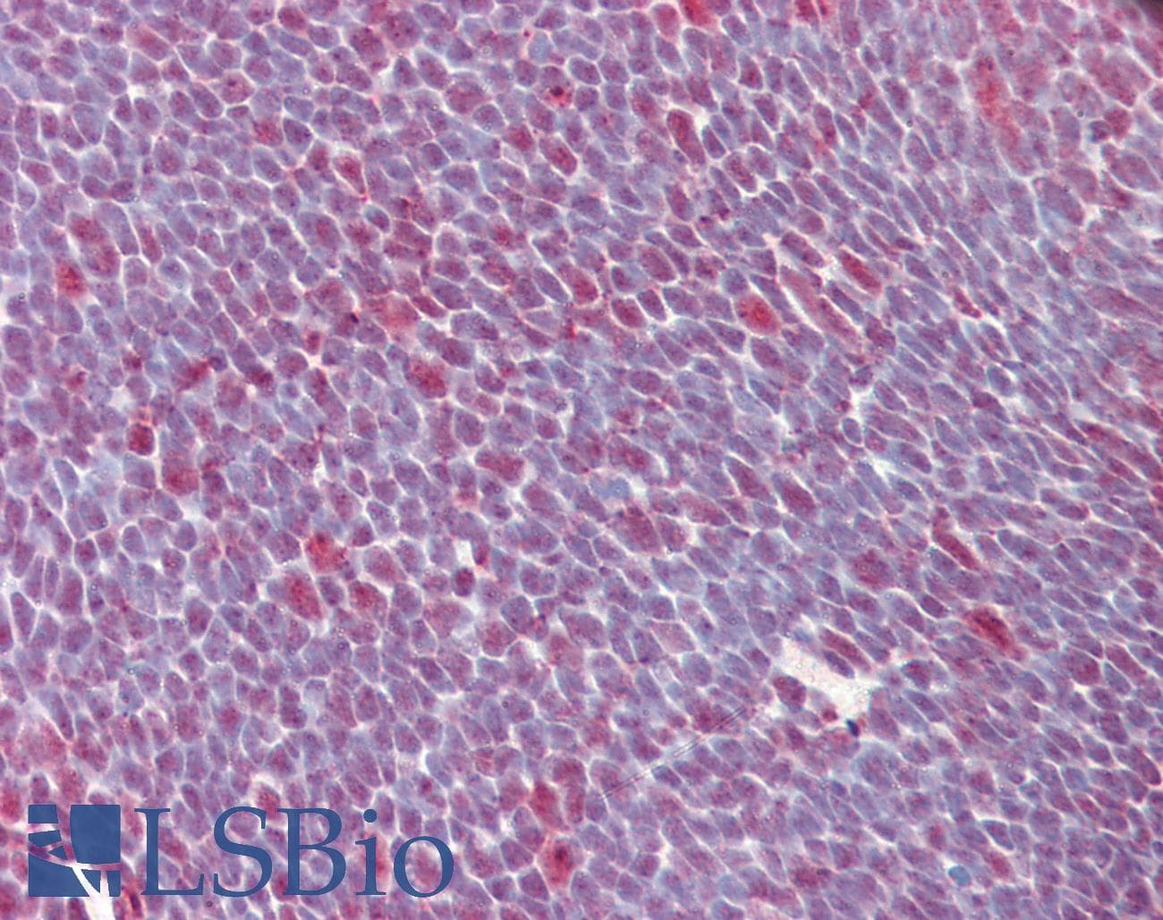 IHC-plus™ Monoclonal Mouse anti-Human SRSF1 / SF2 Antibody (N-Terminus, IHC, IF, WB)