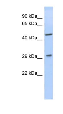 Polyclonal Rabbit anti-Human LIX1 Antibody (aa71-120, WB)