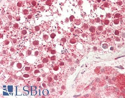 ERIC-1 / TACC3 Antibody (aa503-552)