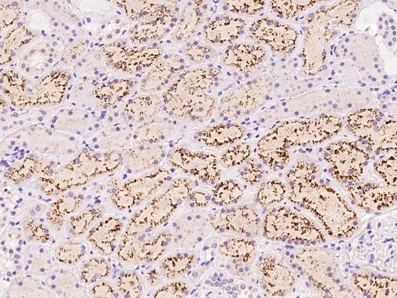 MBP / Maltose Binding Protein Antibody