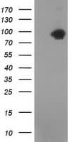 CTNNB1 / Beta Catenin Antibody (clone OTI1E10, Carrier-free)