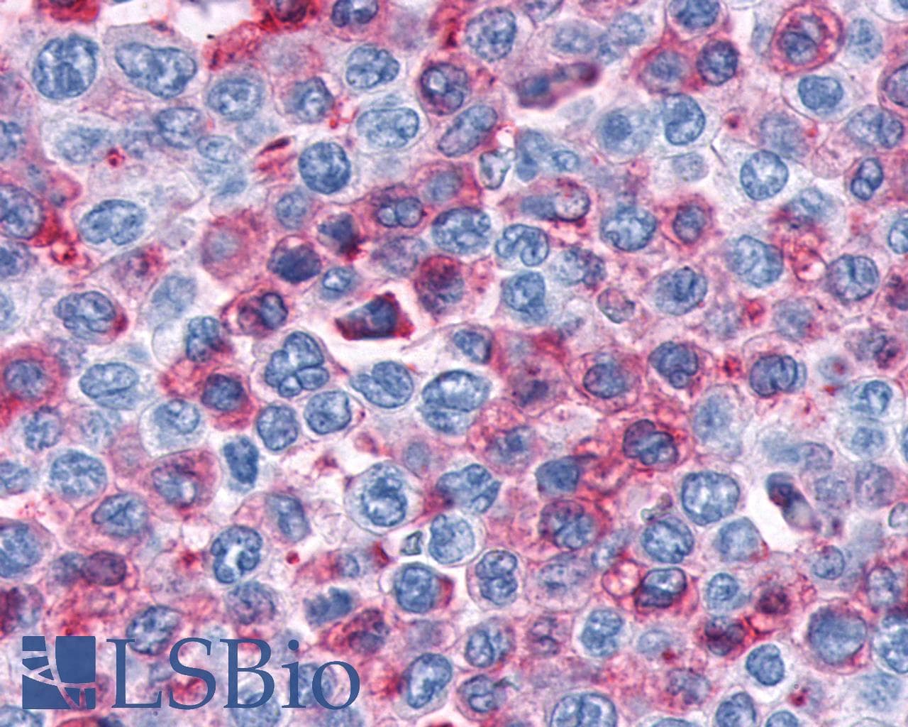 PathPlus™ Polyclonal Rabbit anti-Human CNR1 / CB1 Antibody (C-Terminus, IHC)