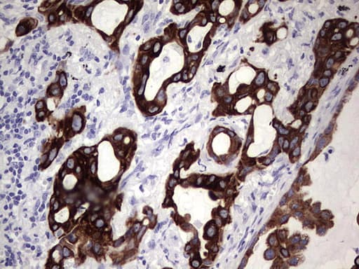 Monoclonal Mouse anti-Human KRT19 / CK19 / Cytokeratin 19 Antibody (clone OTI1F5, aa240-390, IHC, WB)