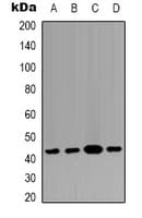 Polyclonal Rabbit anti-Human MAPK14 / p38 Antibody (Internal, IHC, WB)