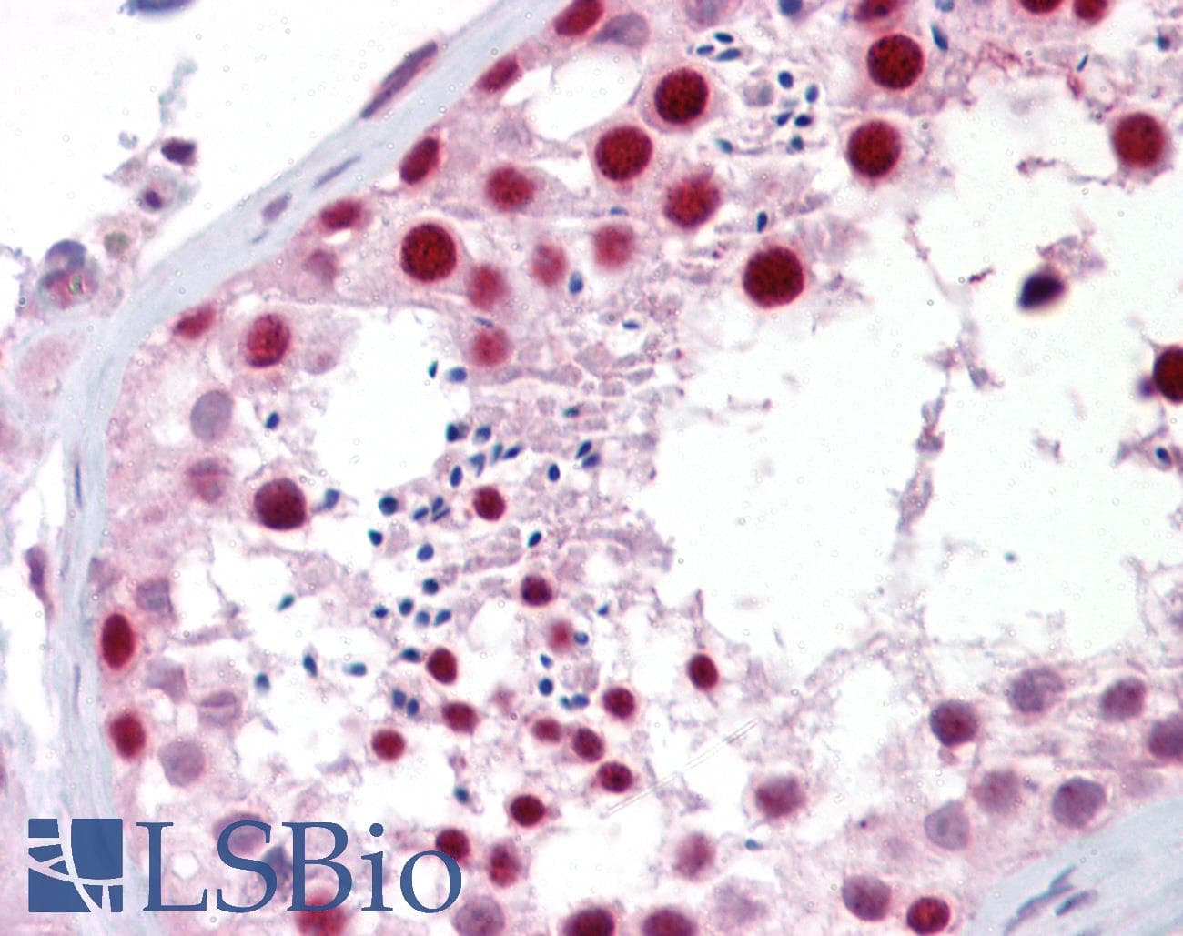 IHC-plus™ ANAPC1 / APC1 Antibody